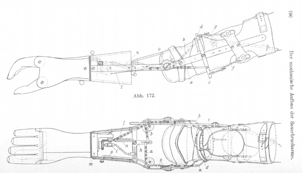 Mechanischer Aufbau des Sauerbrucharmes